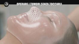 PECORARO: Operare i tumori senza toccarli thumbnail