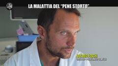 NINA: La malattia del "pene storto"