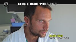 NINA: La malattia del "pene storto" thumbnail