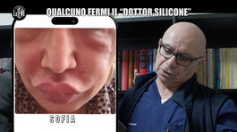 MARTINELLI: Qualcuno fermi il "dottor silicone" thumbnail