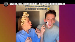 CIZCO: Vivere con un corpo che non puoi controllare thumbnail