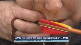 Ancona, sopravvive due giorni con una freccia nella testa thumbnail