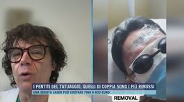 I pentiti del tatuaggio, quelli di coppia sono i più rimossi thumbnail