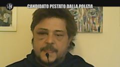 Il candidato Toni della Pia: "Pestato dalla polizia"